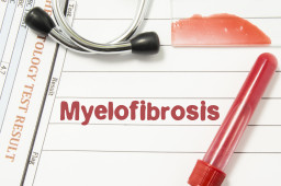 Myélofibrose