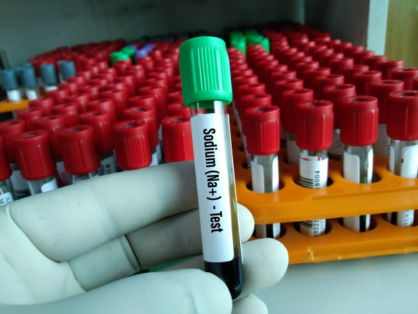 Trop peu de sodium dans le sang (hyponatrémie)