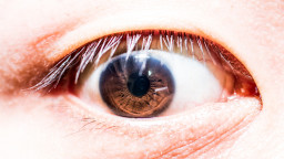 Enroulement du bord de la paupière (entropion et ectropion)