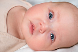 Rétrécissement (sténose) du canal lacrymal