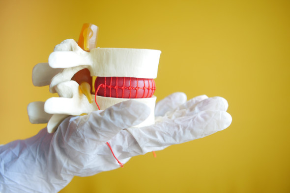 Maladies de la moelle épinière