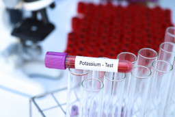 Trop peu de potassium dans le sang (hypokaliémie)